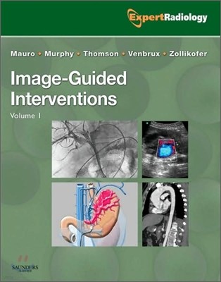 Image-Guided Intervention (2 Vols)