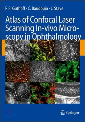 Atlas of Confocal Laser Scanning In-Vivo Microscopy in Ophthalmology: Principles and Applications in Diagnostic and Therapeutic Ophtalmology