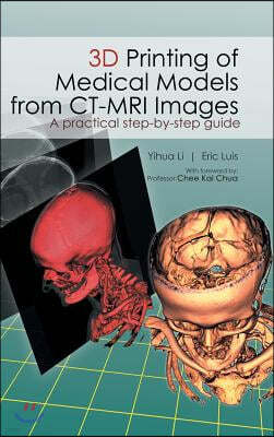 3D Printing of Medical Models from CT-MRI Images: A Practical step-by-step guide