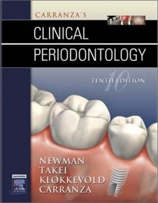 Carranza's Clinical Periodontology, 10/E