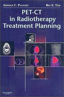 PET-CT in Radiotherapy Treatment Planning