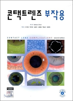 콘택트렌즈 부작용