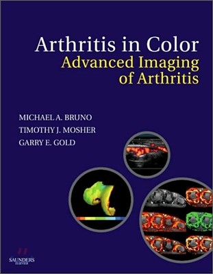 Arthritis in Color