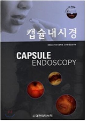 캡슐 내시경