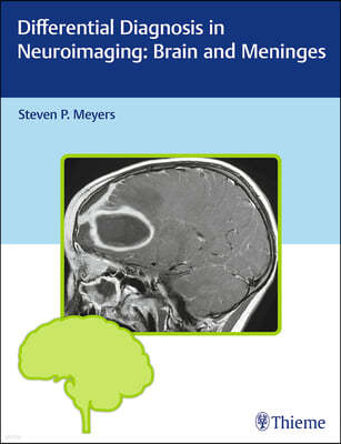 Differential Diagnosis in Neuroimaging: Brain and Meninges