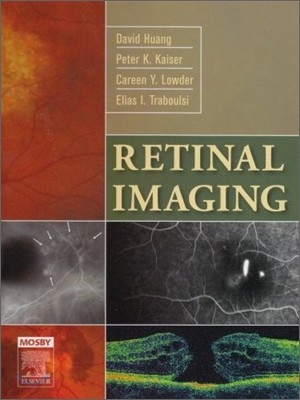 Retinal Imaging