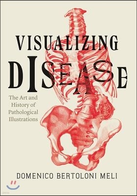 Visualizing Disease: The Art and History of Pathological Illustrations