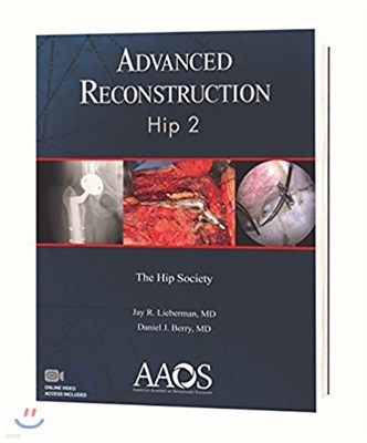 Advanced Reconstruction Hip