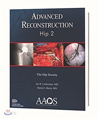 Advanced Reconstruction Hip - 예스24