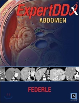 Expert Differential Diagnoses : Abdomen