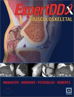 Expert Differential Diagnoses : Musculoskeletal