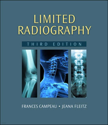 Limited Radiography