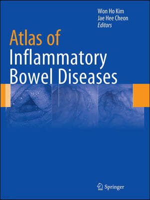 Atlas of Inflammatory Bowel Diseases