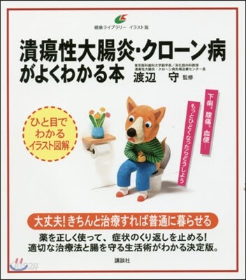 潰瘍性大腸炎.クロ-ン病がよくわかる本