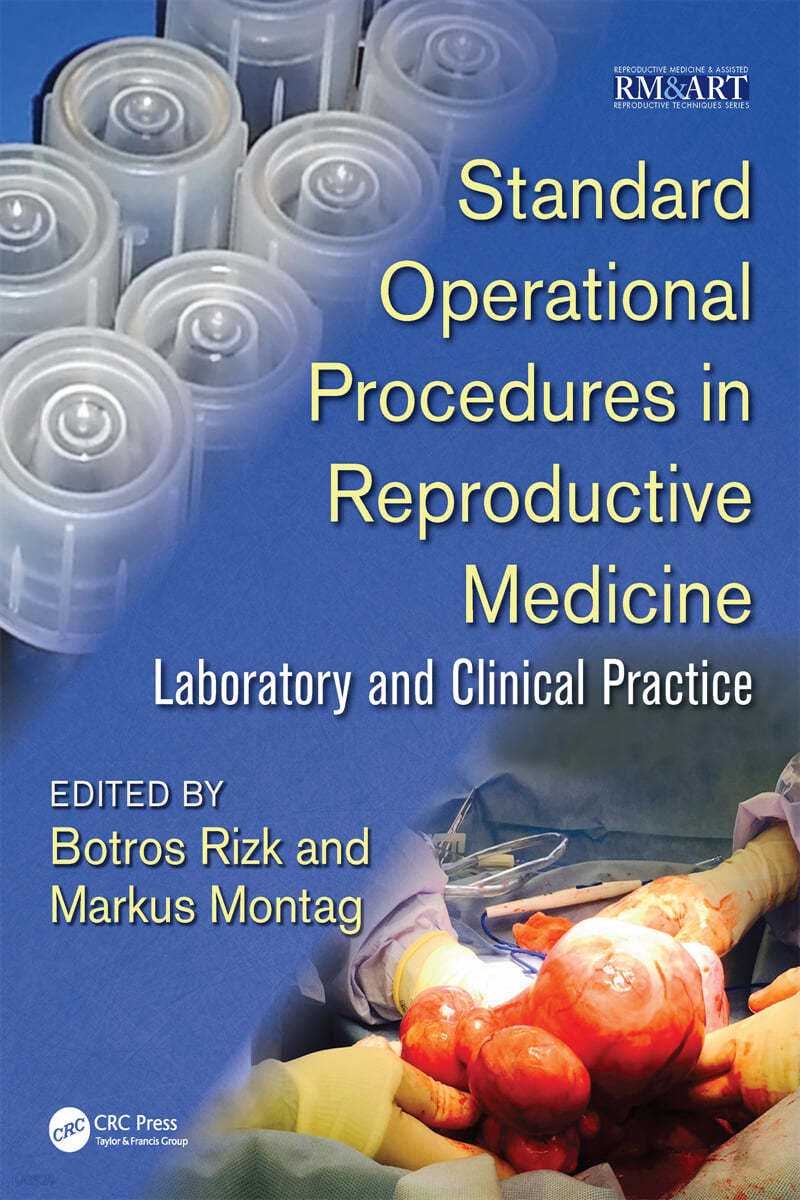 Standard Operational Procedures in Reproductive Medicine