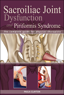 Sacroiliac Joint Dysfunction and Piriformis Syndrome