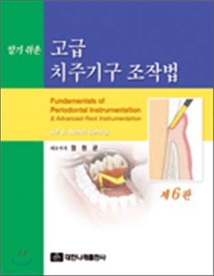 알기쉬운 고급 치주기구 조작법