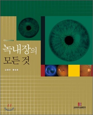 녹내장의 모든 것