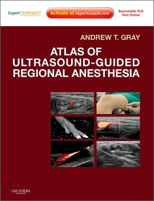 Atlas of Ultrasound-guided Regional Anesthesia
