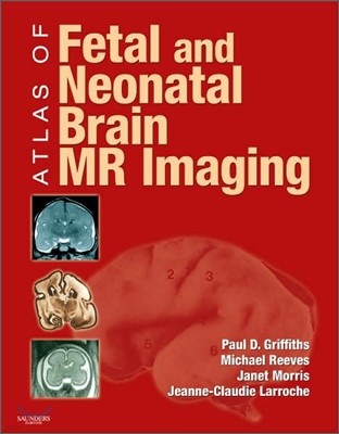Atlas of Fetal and Neonatal Brain Mr