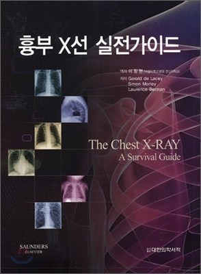  X ̵ The Chest X-Ray A survival guide