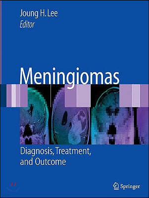 [Neuro]Meningiomas: Diagnosis, Treatment & Outcome