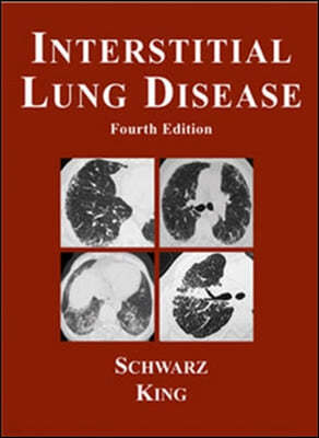 interstitial lung disease,4/e