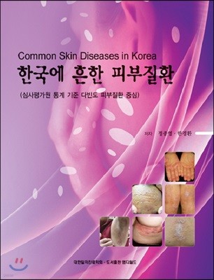 한국에 흔한 피부질환