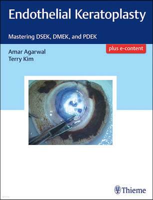 Endothelial Keratoplasty: Mastering Dsek, Dmek, and Pdek