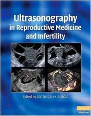 Ultrasonography in Reproductive Medicine and Infertility