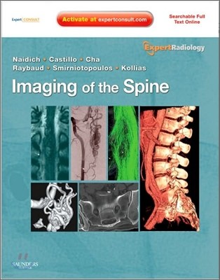 Imaging of the Spine