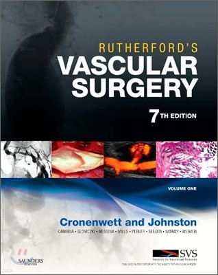 Rutherford's Vascular Surgery, 7/E