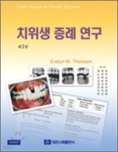 치위생 증례 연구