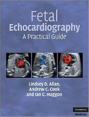 Fetal Echocardiography: A Practical Guide [With DVD]
