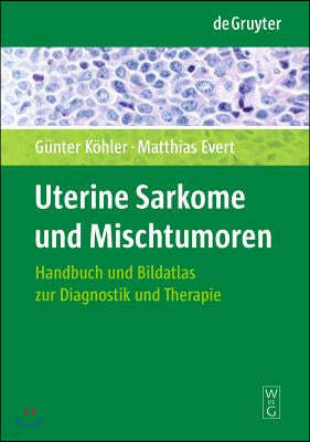 Uterine Sarkome und Mischtumoren