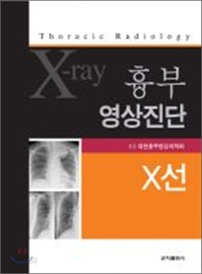 흉부 영상진단 X선