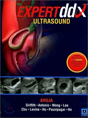 EXPERTddx : Ultrasound