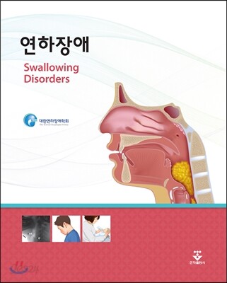 연하장애