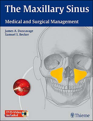 The Maxillary Sinus: Medical and Surgical Management [With 2 DVDs]