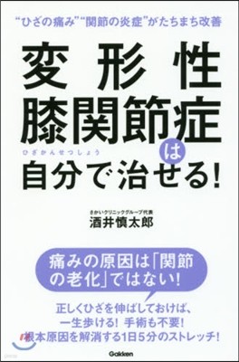 變形性膝關節症は自分で治せる!