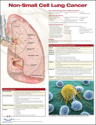 Non-small Cell Lung Cancer