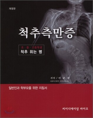 척추측만증