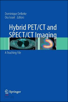 Hybrid PET/CT and SPECT/CT Imaging: A Teaching File - 예스24