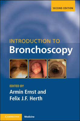 Introduction to Bronchoscopy