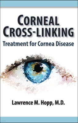 Corneal Cross-Linking: Treatment for Cornea Disease