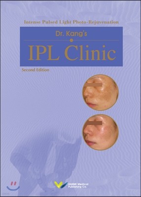 IPL Clinic