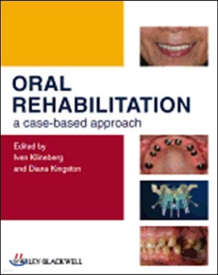 Oral Rehabilitation: A Case-Based Approach [With DVD ROM]