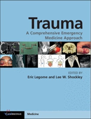 Trauma: A Comprehensive Emergency Medicine Approach