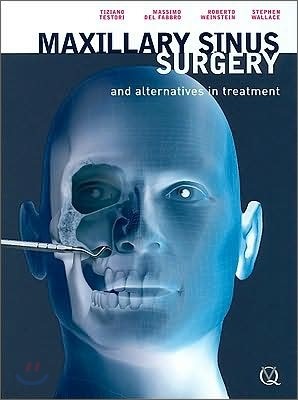 Maxillary Sinus Surgery : And Alternatives in Treatment
