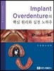 Implant Overdenture ٽ   Ͽ 